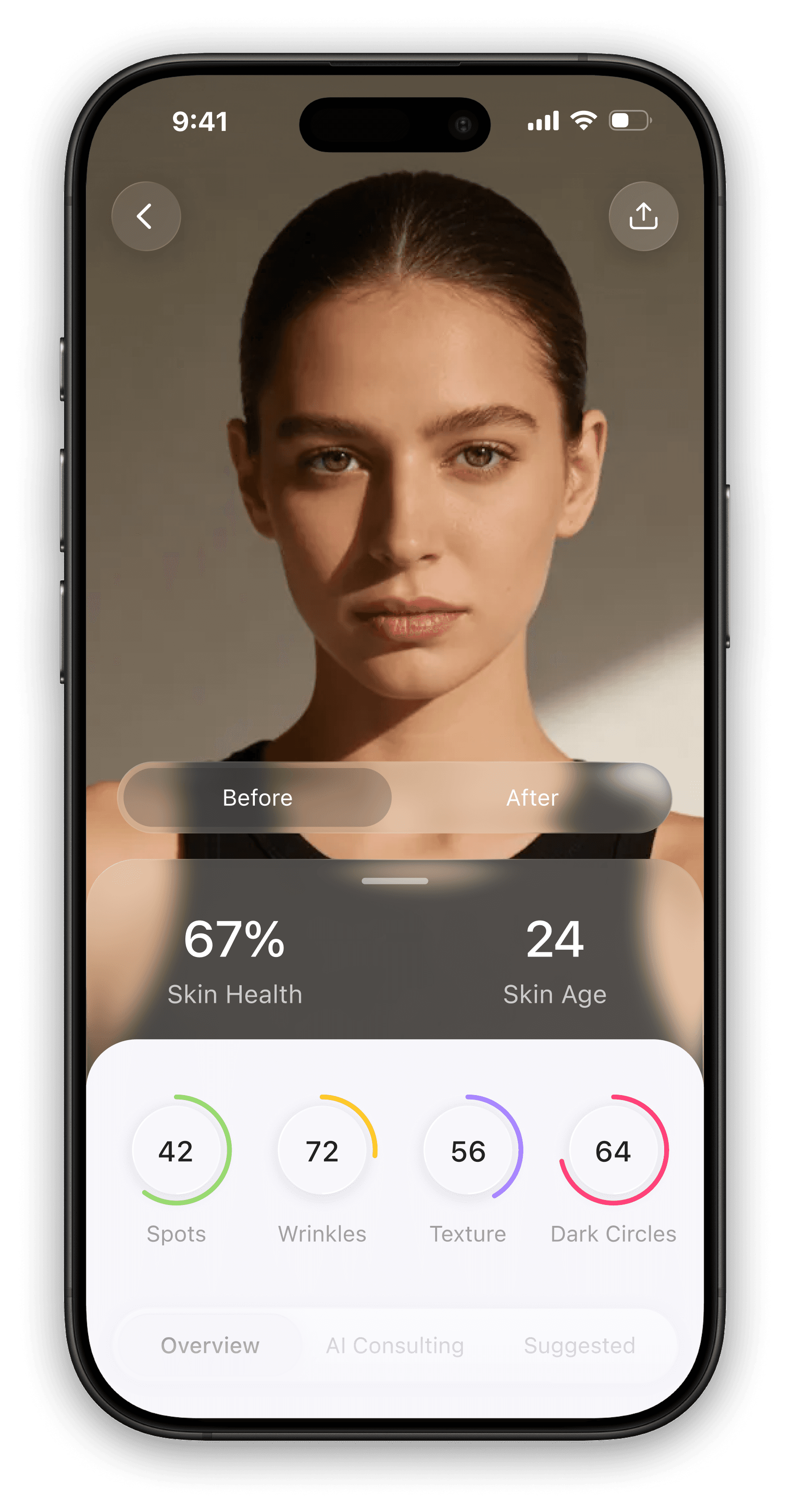 Rhovie skin analysis — skin health, skin age, and per-metric scores